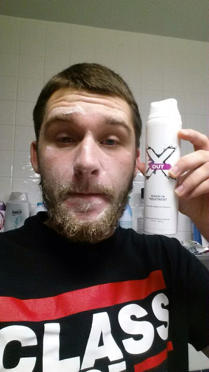 x out acne in wash treatment